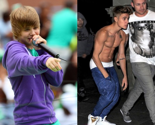 El drástico antes y después de Justin Bieber