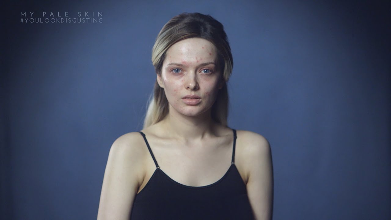 #YouLookDisgusting, la campaña online contra el bullying que incentiva a personas con acné a mostrar su rostro sin maquillaje