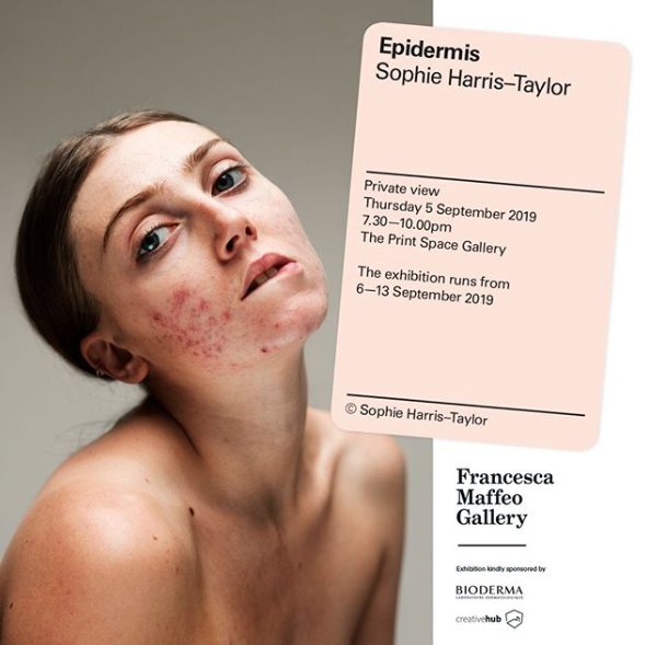 La campaña Epidermis de la fotógrafa Sophie Harris-Taylor